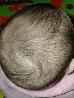 BabyHead